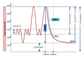 Image result for Vital Capacity