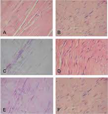 Tendons are similar to ligaments; Tendon Histology Slides H E 40x A Longitudinal Section Of A Download Scientific Diagram