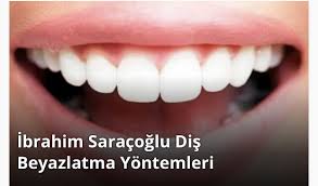 Ibrahim Saracoglu Dis Beyazlatma Yontemleri Saglikli Yasam Saglik Dis