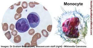 Pin On Diseasemed