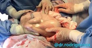 Watch This Triplet Born En Caul And Not Quite Ready To Face The World