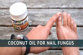 Coconut Oil For Nail Fungus Cong Ty Cổ Phần Thế Giới Organic Thuần Khiết