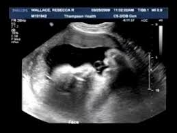 Fetus growth measurement percentile charts graphs. 2 3 Weeks Pregnant Size Of Baby Novocom Top