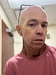 Fundraiser by Jason Holbrooks : First Phase of Treatment