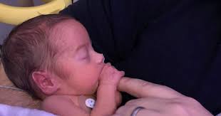 It's not normal, but it will be okay