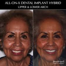 Dental Implants, Orthodontics, Wisdom Teeth & More