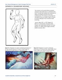 • for the chest, incisions along the mid axillary lines, continuing over the abdominal wall if the burn. Burn Wound Management Under Prolonged Field Care