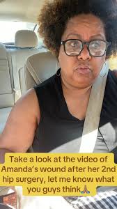 What Surgery Did Amanda Zuckerman Have