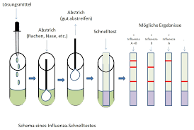 Influenza Schnelltest Wikipedia