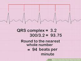 How To Measure And Calculate Heart Rate From Ecg Expert