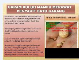 Health matters batu ginjal gejala pengobatan dan pencegahannya 1. Punca Batu Karang
