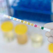 تعرف على ألوان البول بالصور ويب طب