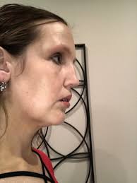 Jeffrey Popp, MD, Oculoplastic Surgeon, Board Certified in Ophthalmology