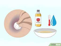 3 Ways To Make A Bruise Go Away Faster - Wikihow