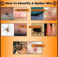 Image result for Tarantula Bite