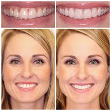 Meet Dr Tyler Broadbent