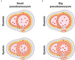 Image result for Pseudoeriosema