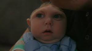 Baby Born With Partially Developed Brain Beats Odds to Meet Santa