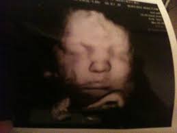 3d/4d ultrasound at 36 weeks... Is it worth it? Pics appreciated..