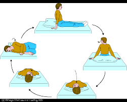 Only those who were diagnosed as a benign paroxysmal vertigo(bppv). Epley Maneuver Using Telemed