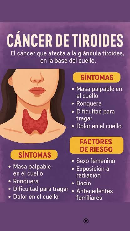 Bulto en el Cuello: Señales de Cáncer de Tiroides