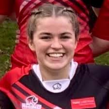 Sepsis after a rugby tackle killed our daughter. NHS staff failed her