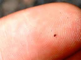 Grumpy's readers have confirmed it! Chiggers On Dogs Best Diagnosis And Treatment