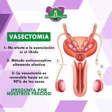 Vasectomía reversible cdmx con la reversión de la vasectomía se vuelve a conectar cada tubo (conducto deferente) que transporta a los espermatozoides de un testículo al semen. Clismuni Una Vasectomia Es Una Cirugia Sencilla Que Facebook