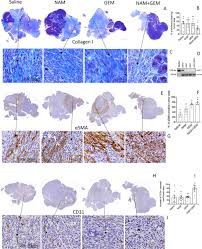 In the vast majority of cases, symptoms only develop after pancreatic cancer has grown and begun to spread. Nicotinamide Combined With Gemcitabine Is An Immunomodulatory Therapy That Restrains Pancreatic Cancer In Mice Journal For Immunotherapy Of Cancer