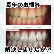 ホワイトニング専門店 Beauty