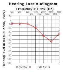 how is hearing measured discovery of sound in the sea