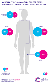 cancer only affects a very small number of in children and teenagers. Melanoma Skin Cancer Incidence Statistics Cancer Research Uk