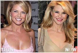 As the saying goes, eyes are the window to the soul, so it is important to keep them as sharp and clear as possible. Billy Kane Lee On Twitter Christie Brinkley Plastic Surgery Former Model Sexier As Ever Pretty Hot Physical Appearance Http T Co Yd6tiaikza Http T Co Tuzk3n9esw
