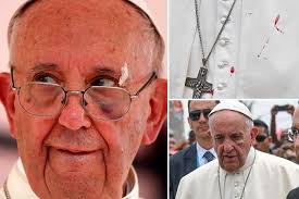 Pope Francis left with a black eye and ...