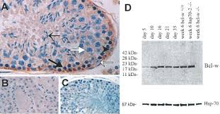 —alan, after monica breaks up with him. Developmental Regulation Of The Bcl 2 Family During Spermatogenesis Insights Into The Sterility Of Bcl W Male Mice Cell Death Differentiation