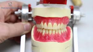 how dentures are made you