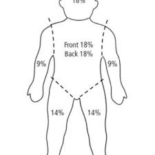 Paediatric Lund And Browder Chart Download Scientific Diagram