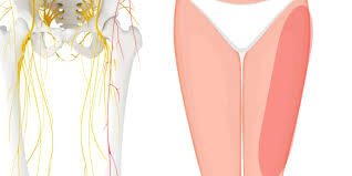 Image result for Paresthesia