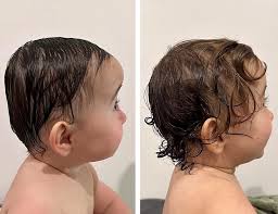 This cutie just graduated from her @taleetop Cranial Remoulding Helmet  Therapy ➡️ Swipe to see the final results 😍 Well done to Luella for your  hard work over the last four months