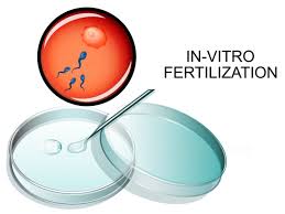 In Vitro Fertilization Ivf Infertility Aide