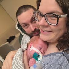 Does premature baby need therapy?