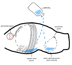 Image result for PECARN Pediatric Intra-Abdominal Injury Algorithm