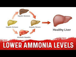 How To Lower Your Ammonia From Liver Cirrhosis And Other Conditions Youtube Liver Disease Dr Berg Cirrhosis