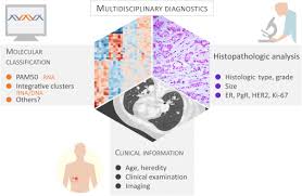 The cancer antigen 27.29 (ca 27.29) test is a blood test used to detect an antigen associated with breast cancer. Breast Cancer Molecular Stratification From Intrinsic Subtypes To Integrative Clusters Sciencedirect