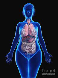 Conditions that affect men and women. Illustration Of An Obese Woman S Internal Organs Photograph By Sebastian Kaulitzki Science Photo Library