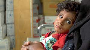 Clarissa ward was born on january 30, 1980, in new york, u.s.a.she graduated from yale university and has earned her honorary doctor of letter. Yemen The Markets Have Food But Children Are Starving To Death Cnn