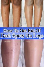 Pin On Skin Care