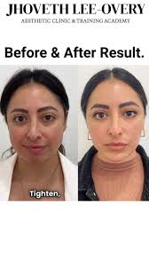 ✨ Looking for a non-surgical...