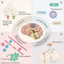 Image result for Stroke Pathophysiology