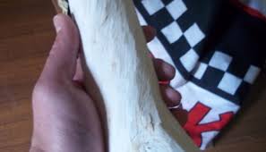 Image result for Synaptolepis